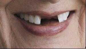 乳瓜怎样吃不塞喉咙呢视频,告别喉咙不适的食用技巧